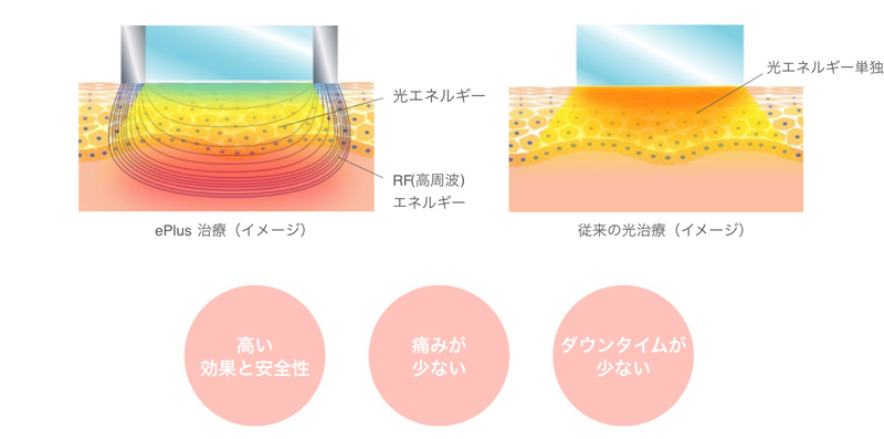 トリニティプラス