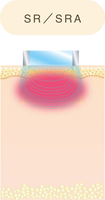SR／SRA