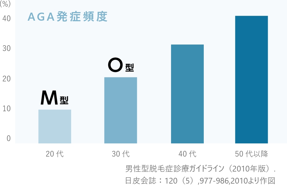 男性型脱毛症の発生頻度