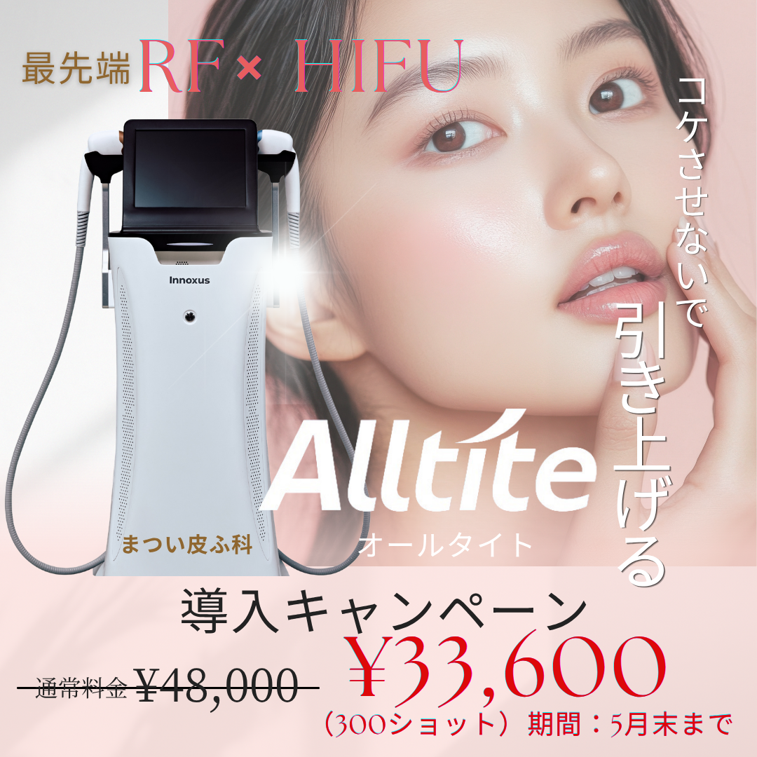 オールタイト導入キャンペーン