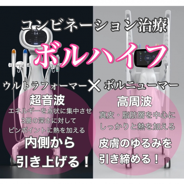 ボルニューマー新導入